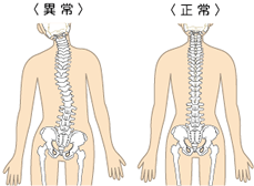 骨盤アイキャッチ 骨盤アイキャッチ